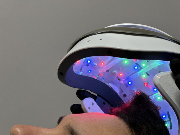 Revitaliza tu cabello con el casco capilar LED: tecnología y resultados