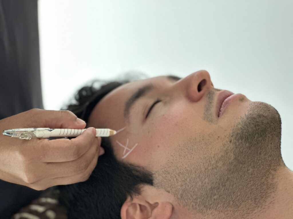 Hidratación profunda y calidad de piel con skinbooster