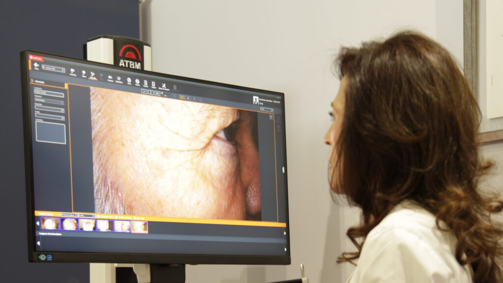 La Dra. Eva García Hervías revisando en la pantalla de FotoFinder las imágenes de dermatoscopia digital de una paciente