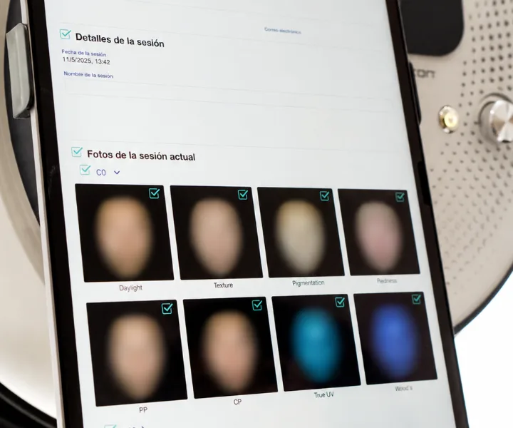 Tablet del equipo Observ 520x en Clínica Lunik mostrando el reporte de análisis de piel con las imágenes multiespectrales de la sesión
