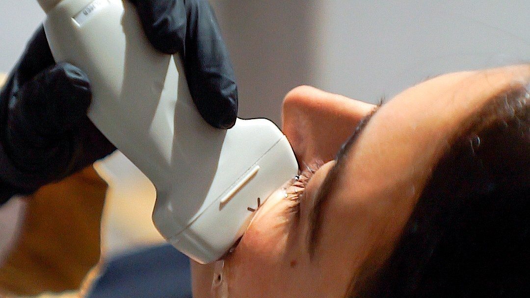 Ecografía cutánea del rostro con sonda sobre la mejilla de una paciente en el Centro NES de Clínica Lunik